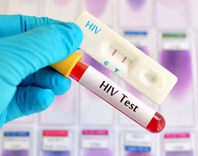 Islamabad HIV cases rise