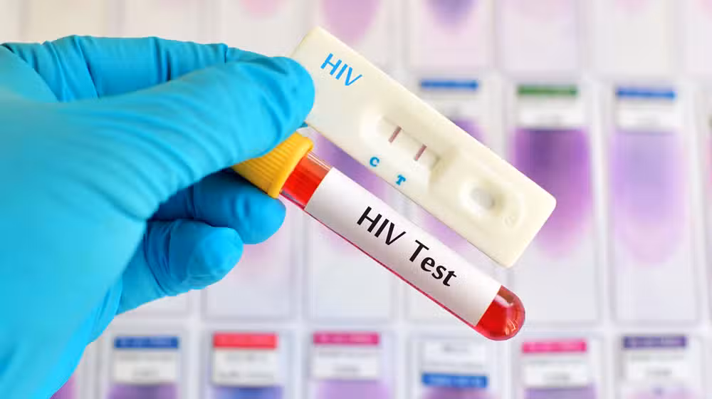 Islamabad HIV cases rise