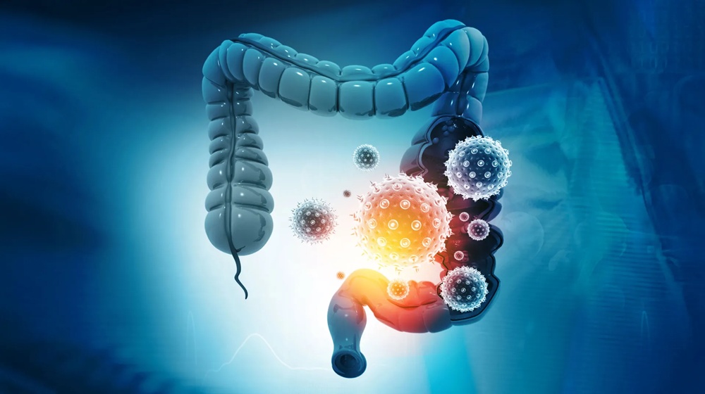 Scientists Find Early Warning Signal Transforming Colon Cancer Detection