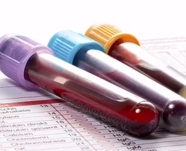 blood test mandatory for Nikkah