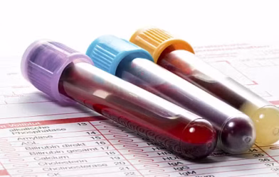 blood test mandatory for Nikkah