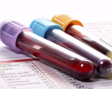blood test mandatory for Nikkah
