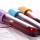 blood test mandatory for Nikkah
