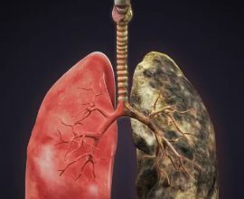lung cancer drug trial