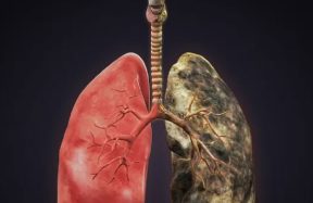 lung cancer drug trial