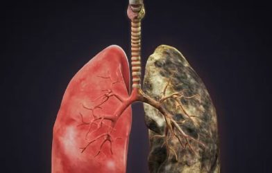 lung cancer drug trial