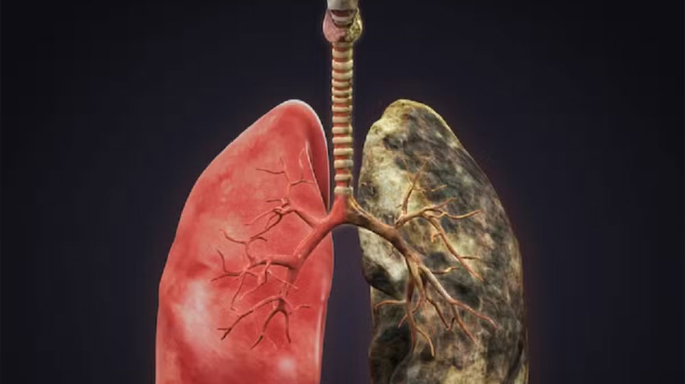 lung cancer drug trial