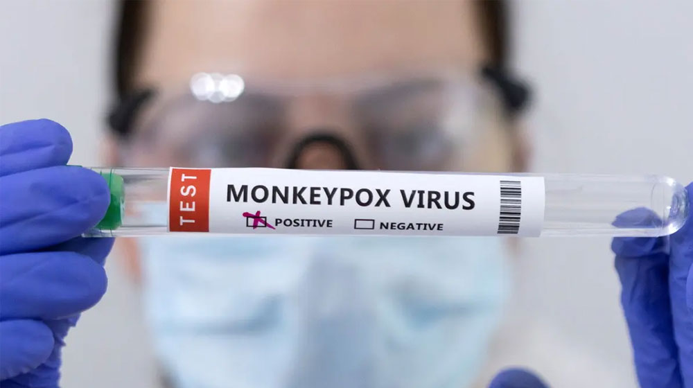 Sindh Monkeypox cases